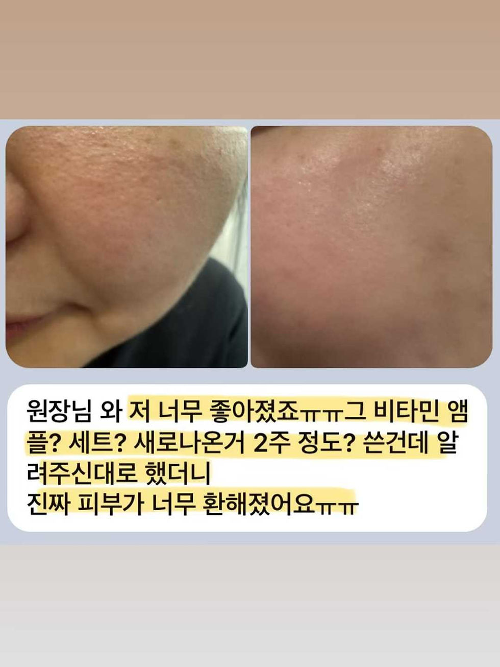 縮圖：Pharmesthetic Zolopix Mintavi 20 Vitamin C 20% Ampoule