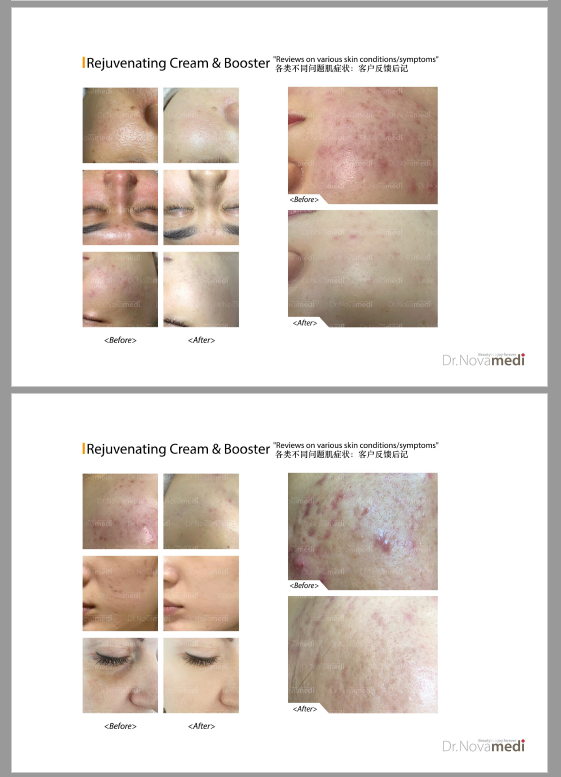 縮圖：Dr.Novamedi Professional Rejuvenating Cream SV and Booster