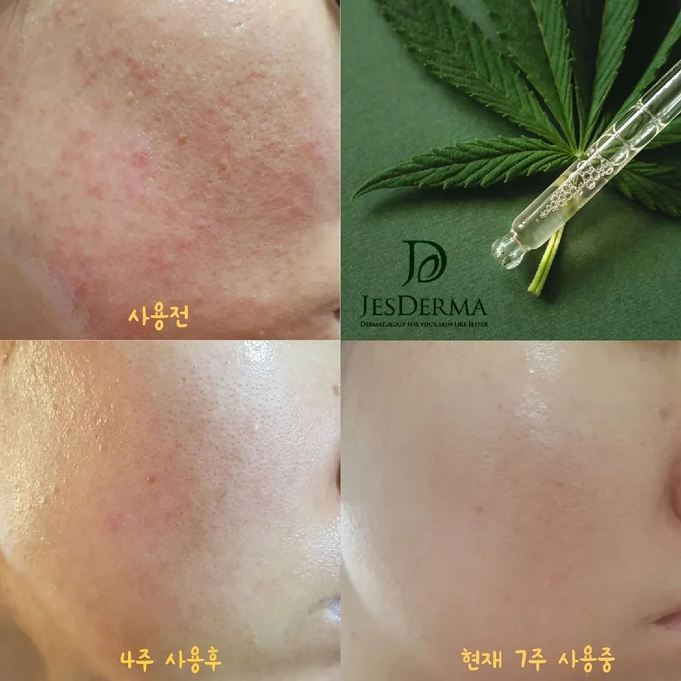 Jesderma Cannabis Rejuvenating