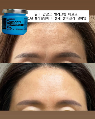 Cemenzal High Potency Cream 50ml 2個セット Cemenzal High Potency Cream 50ml 2個セット | 美容液