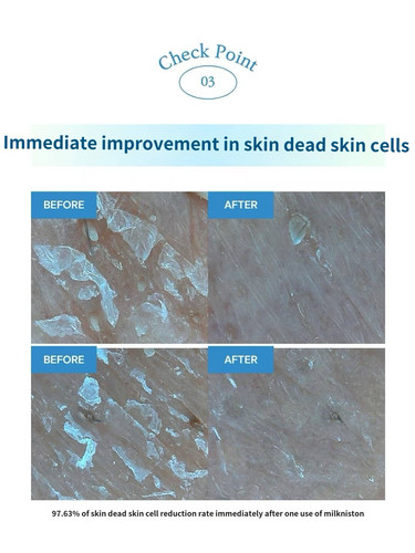 USA Seller-Pharmesthetics Conapidil Uyuni Stone Sebum Care Kit