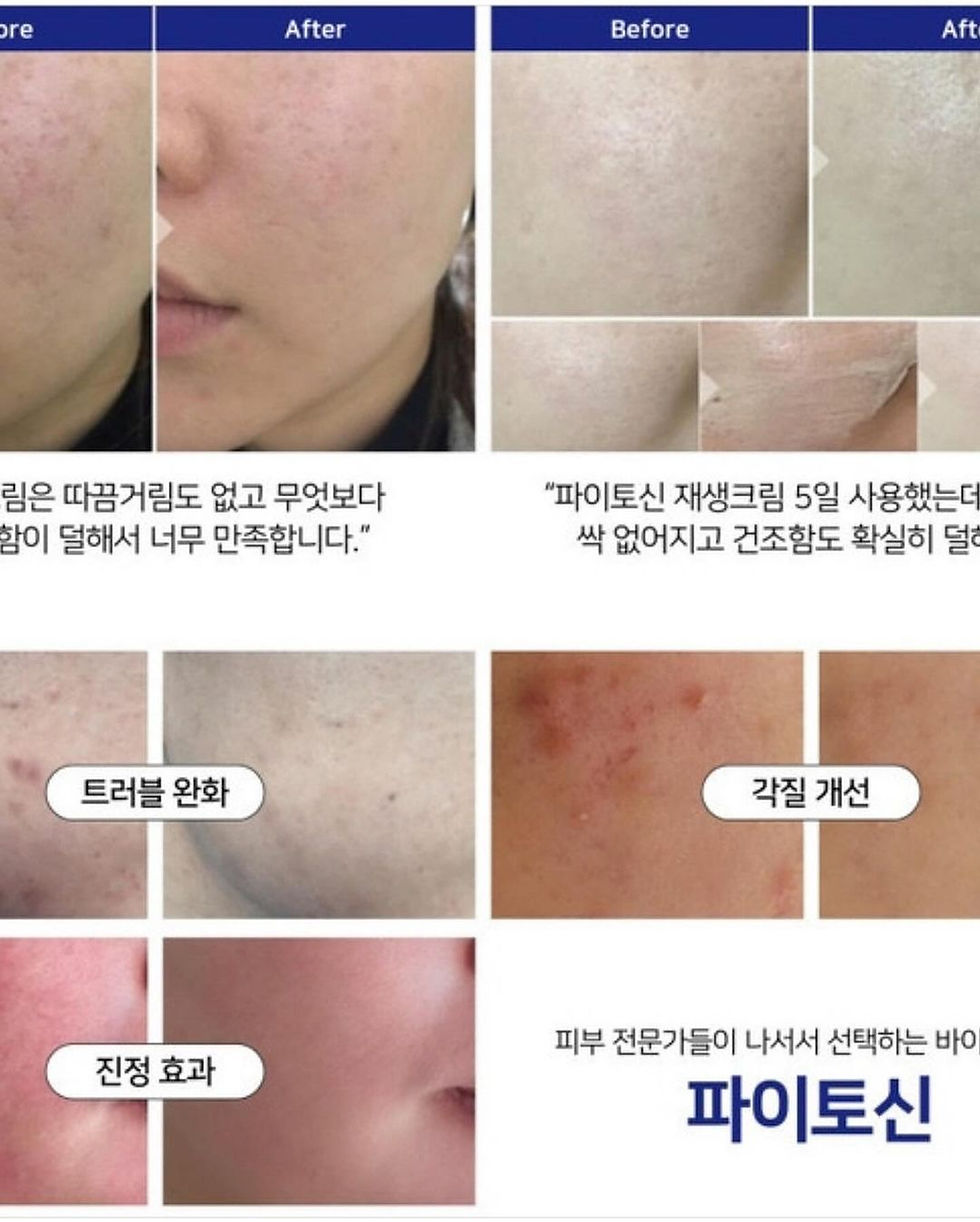 縮圖：Vibanqm Lotion Phytocin V2