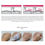Thumbnail: Silisca RH-Oligopeptide-1 Cicatries Ointment Cream