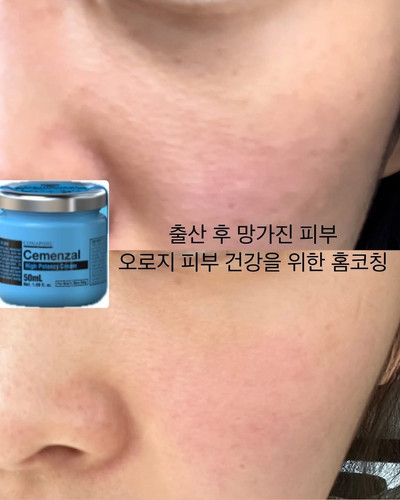 USA Seller-Pharmesthetics Conapidil Cemenzal High Potency Cream