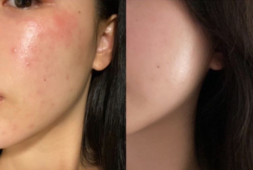USA Seller- Belle Kosmetik Skin Repair Serum Elixier-30ml