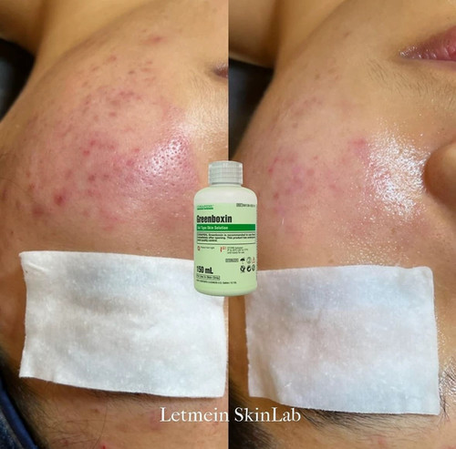 USA Seller-Pharmesthetics Conapidil Greenboxin Gel Type Solution