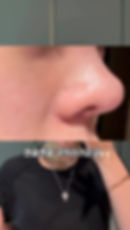 Thumbnail: Pharmesthetics VQM Axenda Routiner Cream