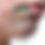 Thumbnail: Pharmesthetics VQM Phytocin V2 Hybrid Cream
