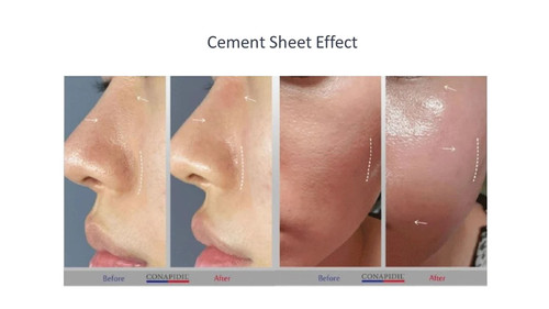 CANAPIDIL CEMEN SHEET セメンシート 5枚 s-l400.jpg