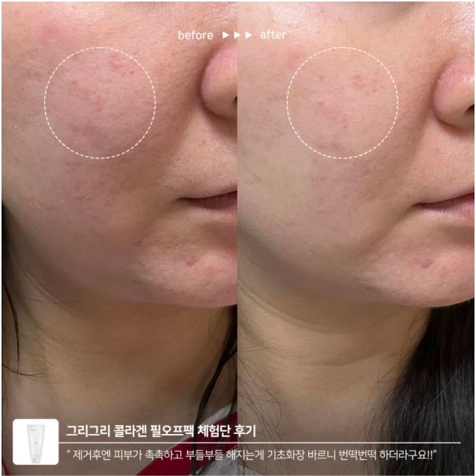 縮圖：Grigri Iluminar Peel Off Mask Pack