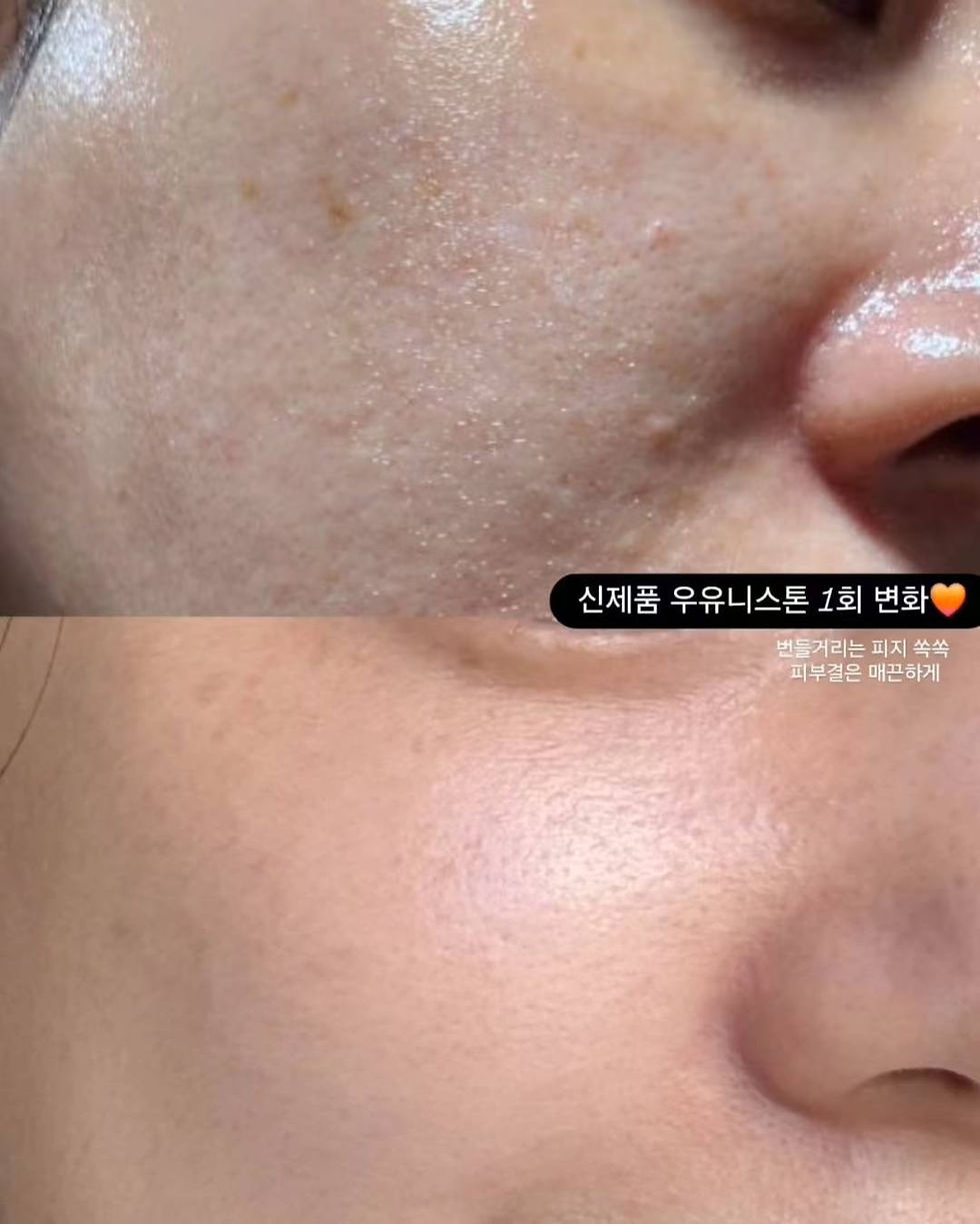 縮圖：Conapidil Value Set Uyuni Stone Sebum Care Kit Calmen Sheet