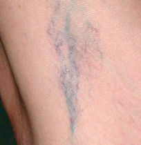 veins b.jpg