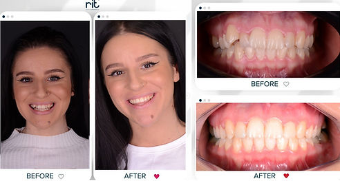 Before vs After 01.jpeg