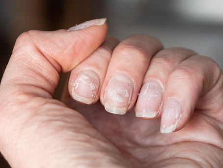 Nail Health - Tips to help you with clients