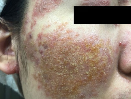 症例71　※写真をクリックして下さい