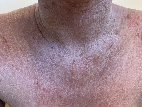 症例166　※写真をクリックして下さい