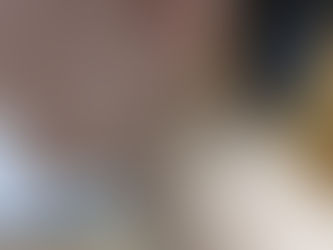 症例44　※写真をクリックして下さい