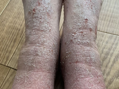 症例86 ※写真をクリックして下さい