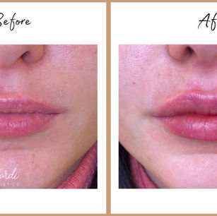 לפני אחרי 6.jpg