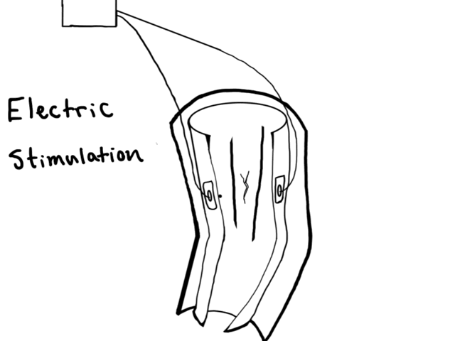 Electric stimulation_640X480.gif
