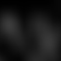 Crabs & Feathers step into the open air with 'Rarefaction'