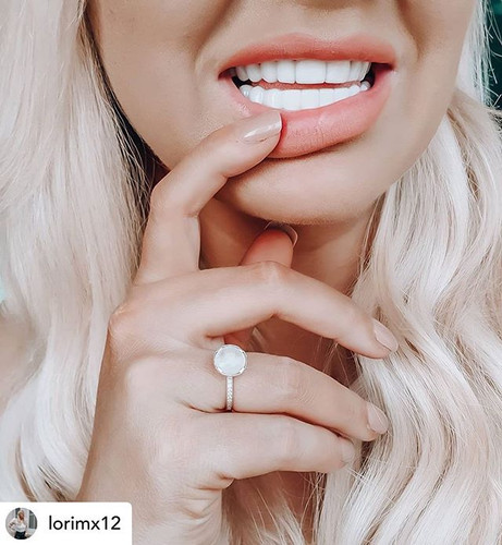 Upper Lower Standard Secret Veneers Online Aesthetics