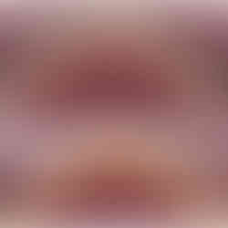 Limpieza dental antes y despues