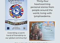Lymphoederma United 2nd book with thirty four personal stories from around the world on what it is like to live with lymphoedema. Photograph of Gaynor Leech showing her chapter.