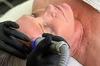 Cryo Facial.jpeg