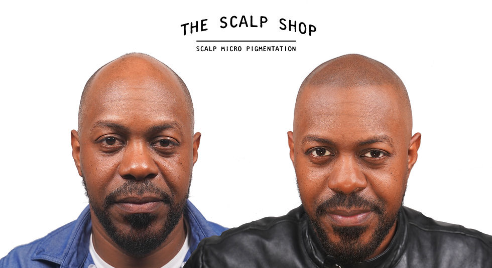 Jelly Before + After SMP Front