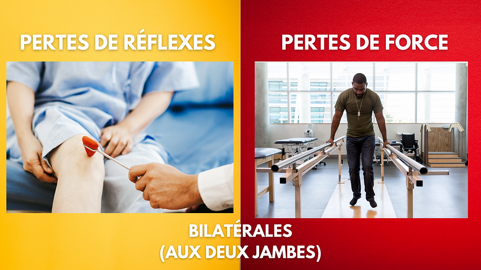 Les pertes de force motrice ou de réflexes ostéo-tendineux associées avec le syndrome de la queue de cheval o