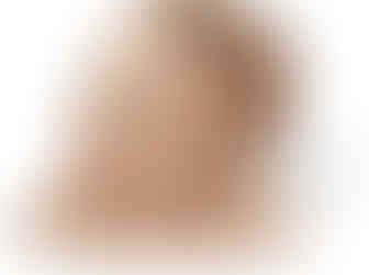 Torticolis pédiatrique aussi appelé pseudo-tumeur