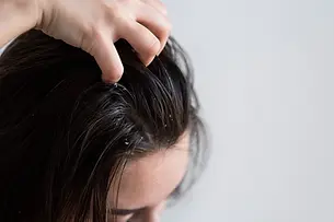 Dandruff & Hair Fall Control