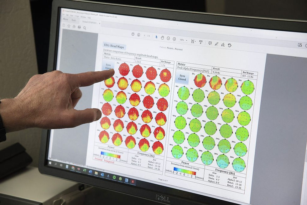qEEG brain map.jpg