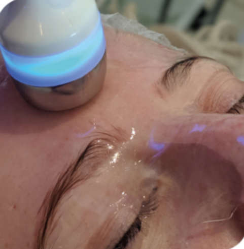 "Ultrasound handpiece with LED light infusing serum into the skin during facial treatment." Description: A continuation of t