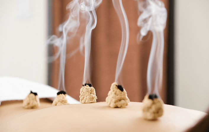 Das Bild zeigt Moxibustion und zu sehen ist ein Rücken mit den wärmenden Elementen der Therapiemethode, aus denen etwas Rauch austritt