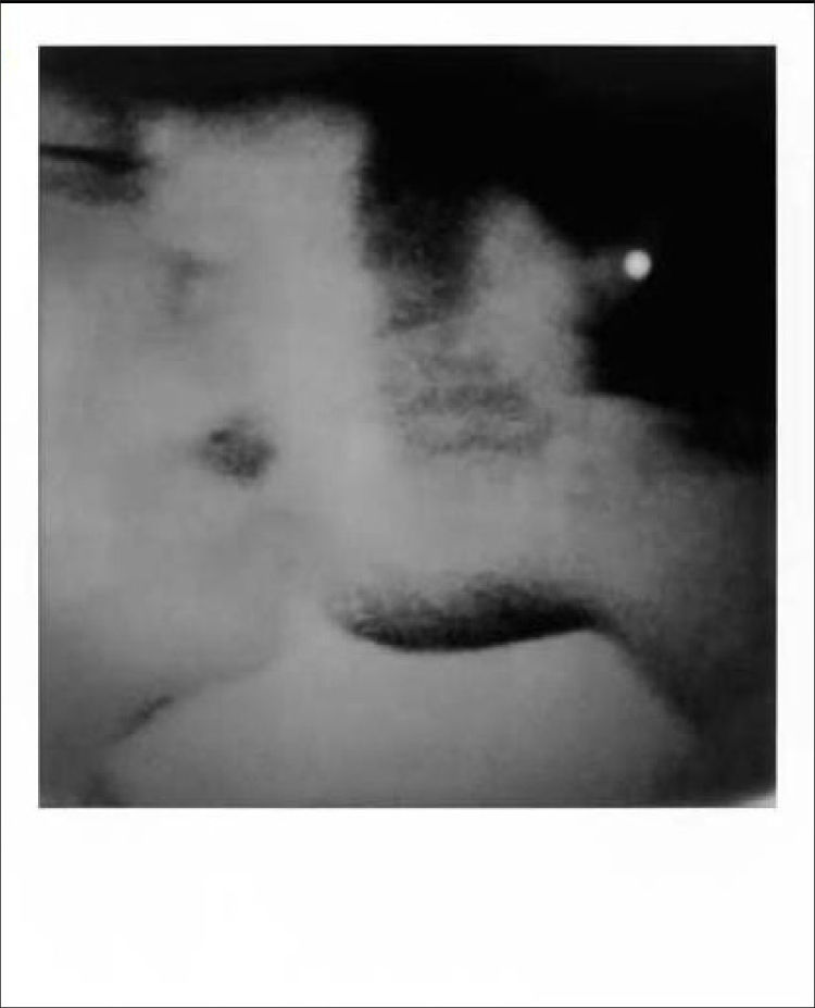 Thumbnail: A PROPOS D'ANDERS PETERSEN – limited edition