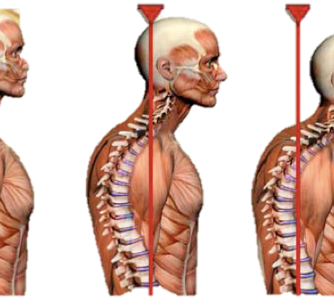 Is your posture causing your headaches?