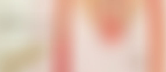 What are your options if you have heavy menstral bleeding due to fibroids? Just hysterectomy?