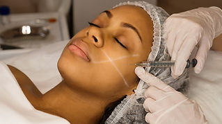 Black Dermatologist Directory, Dermal Filler Black Skin Dermatology, Black Derm Skin Experts, African American Dermatologist, Skin of Color Dermatology
