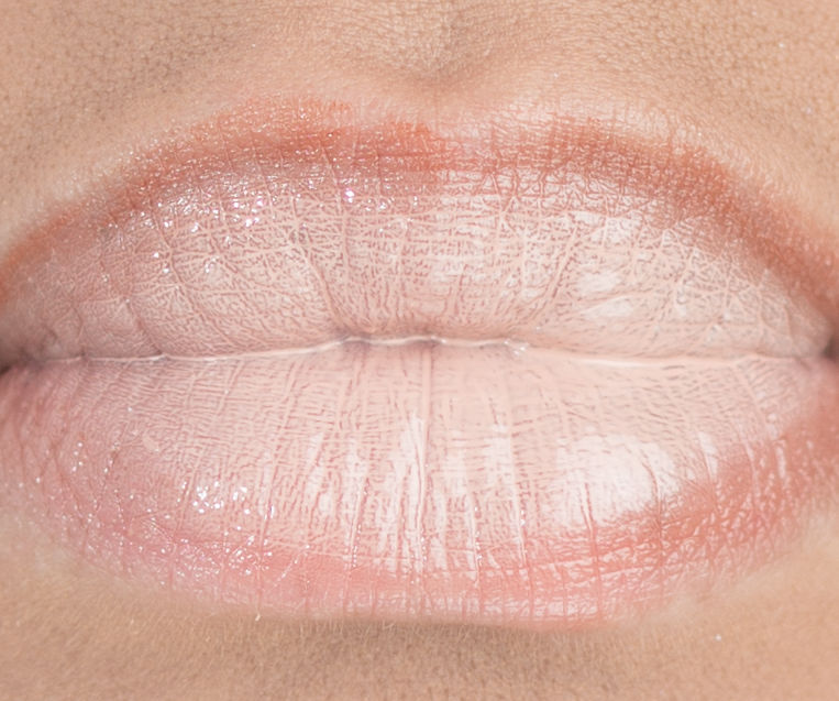 Thumbnail: Celebrity