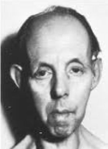 Síndrome de Steinert