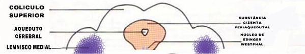 motor3.JPEG