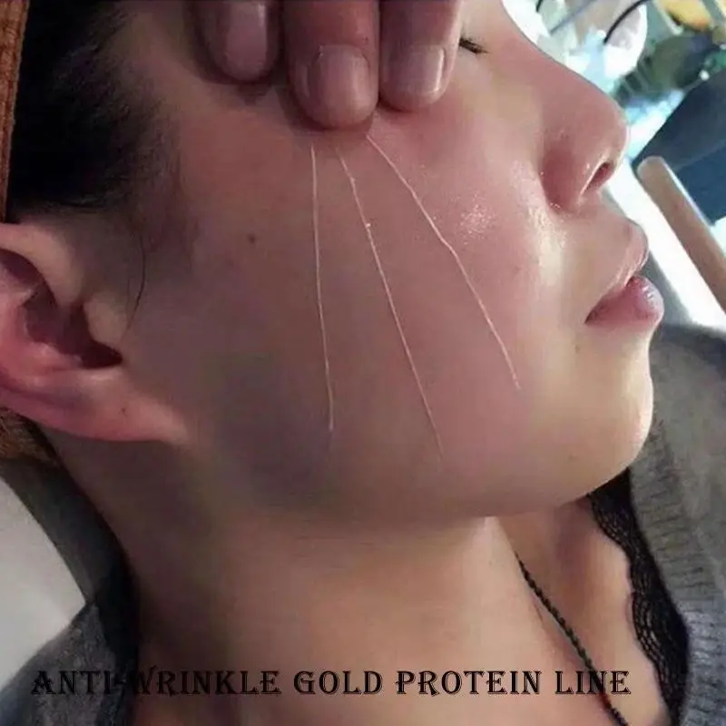 Thumbnail: Instant Lifting Collagen Protein Thread Wrinkle Removal Facial Filler Absorb