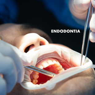 ENDODONTIA