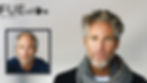 HAIR TRANSPLANT NEW ORLEANS: ADVANCED HAIR RESTORATION WITH FUESION HAIR CLINICS