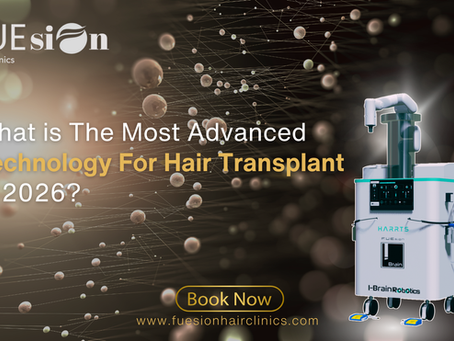 What is the Most Advanced Technology for Hair Transplant in 2026? A Deep Dive into FUEsion Hair Clinics