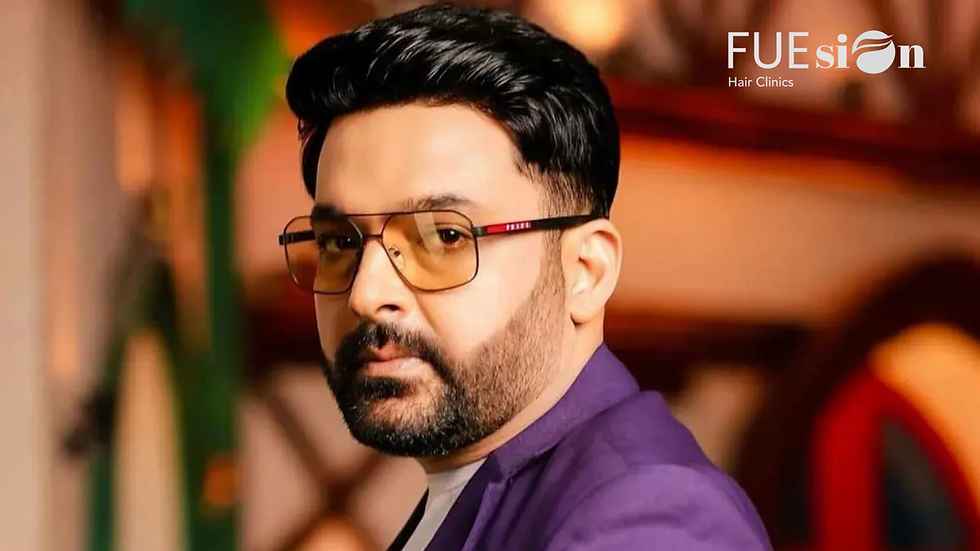 Kapil Sharma Hair Transplant Before and After: Why FUEsion Hair Clinics Is the Gold Standard in Hair Restoration