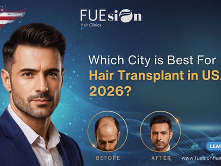 Which City is Best for Hair Transplant in USA 2026? FUEsion Hair Clinics Leading The Way