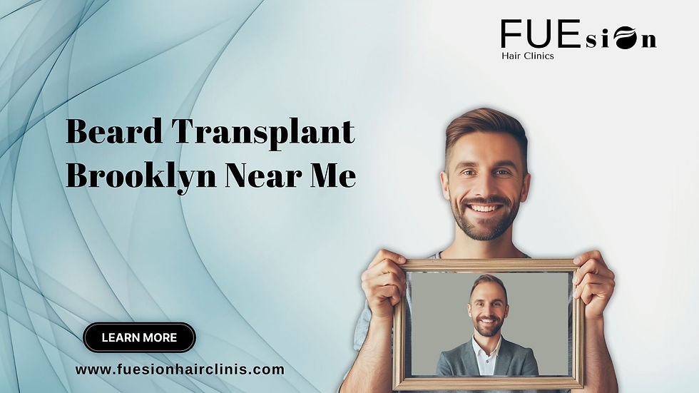 BEARD TRANSPLANT BROOKLYN NEAR ME: FUESION HAIR CLINICS